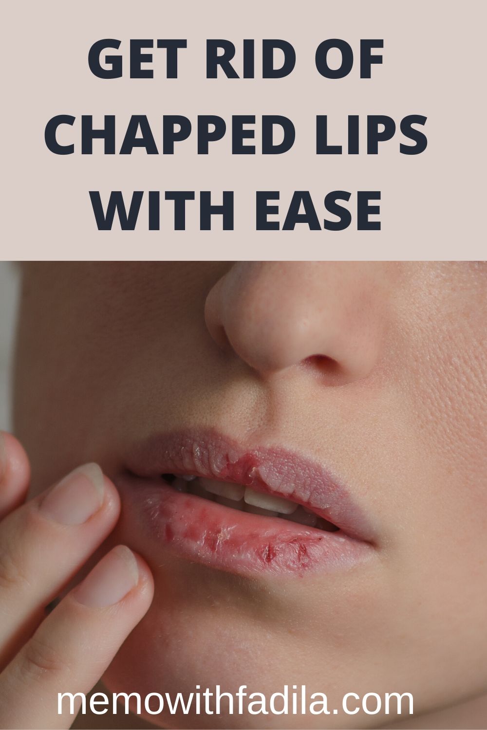 Get Rid Of Chapped Lips With Ease Memo With Fadila 0724